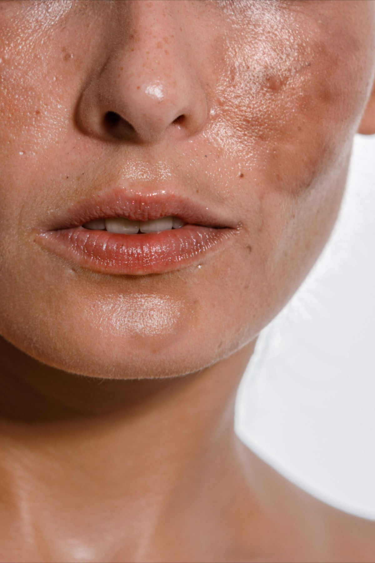 Pigmentation