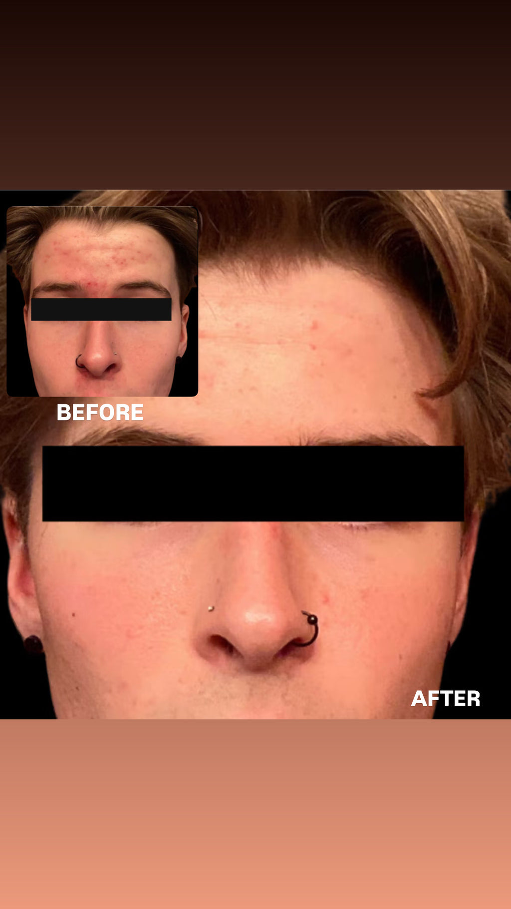 SIV BIOME BALANCING SERUM