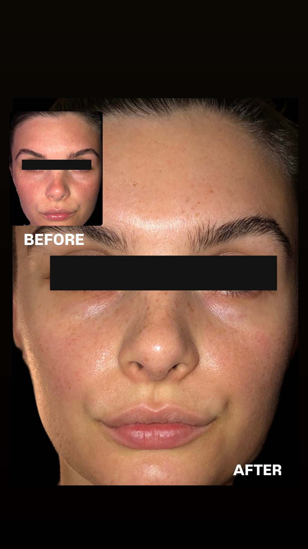 SIV BIOME BALANCING SERUM