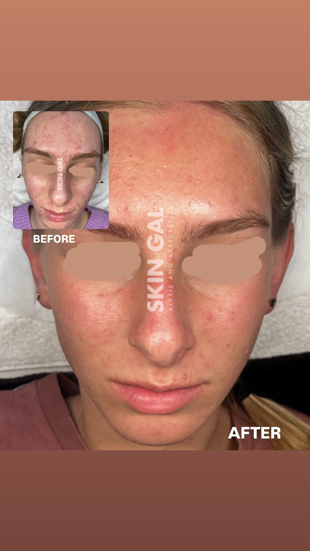 SIV BIOME BALANCING SERUM