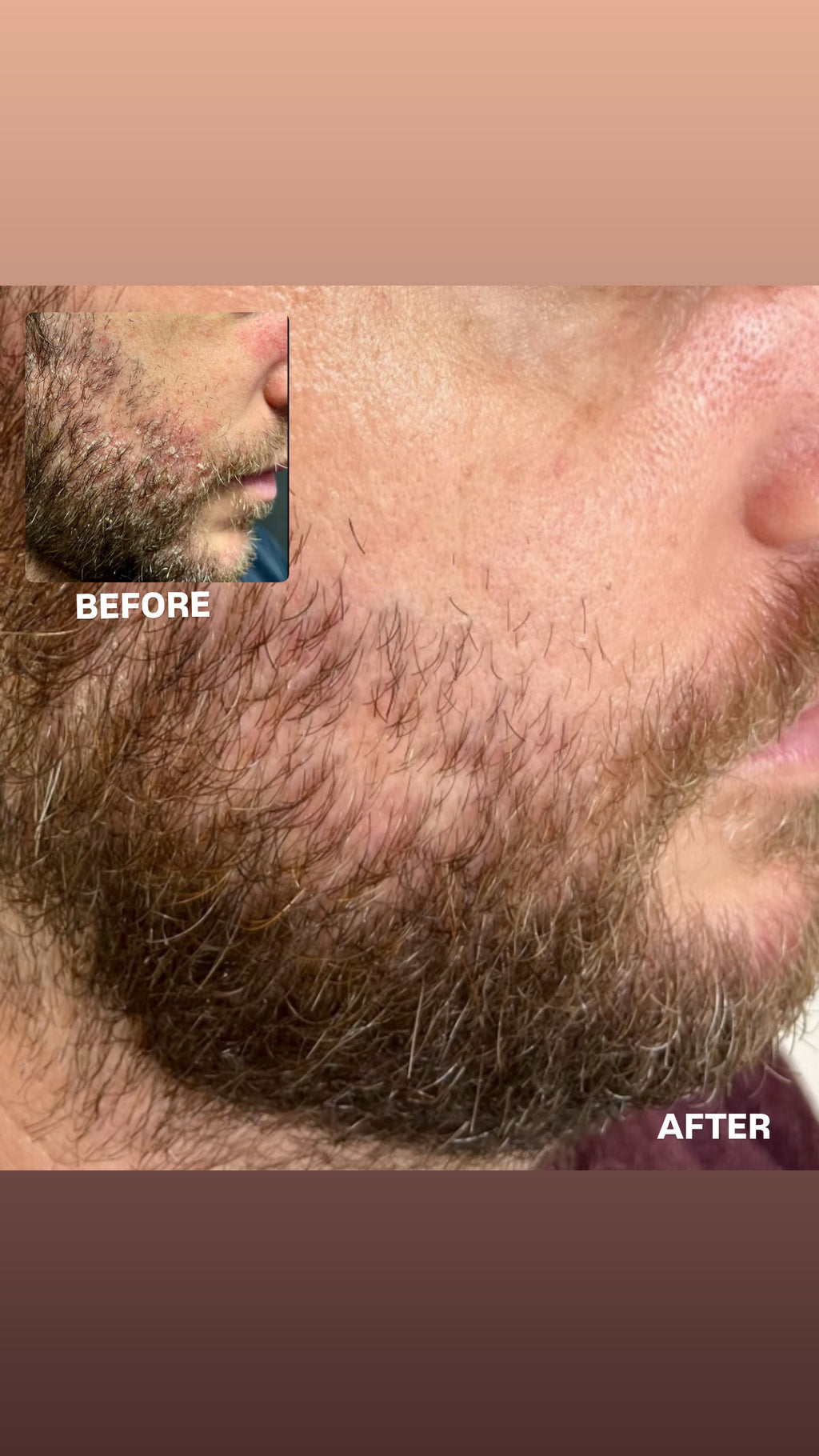 SIV BIOME BALANCING SERUM