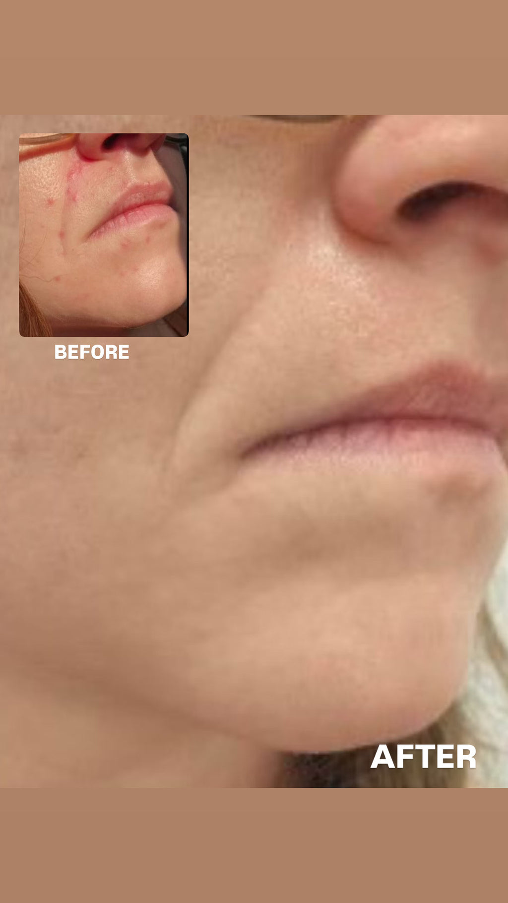 SIV BIOME BALANCING SERUM