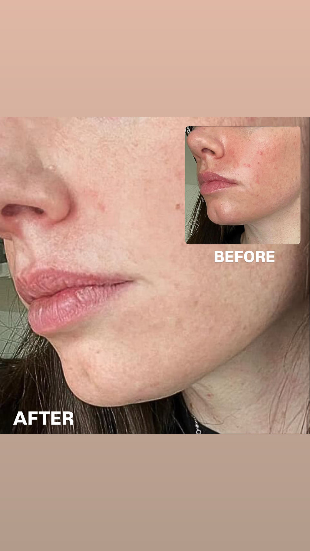 SIV BIOME BALANCING SERUM