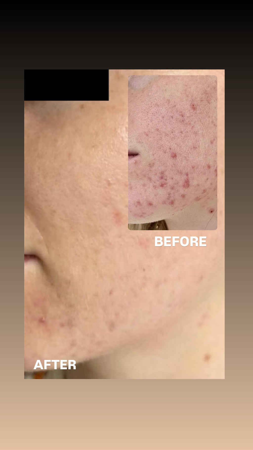 SIV BIOME BALANCING SERUM