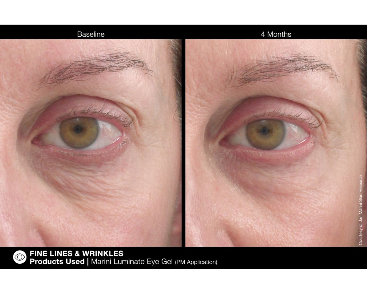 Marini Luminate® Eye Gel (Pre Order)